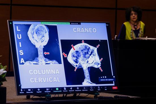 Mexico holds second UFO session featuring Peruvian mummies